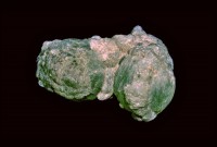 /album/galerie-photos/baigorry-p1-prehnite-6309-mod2-jpg1/